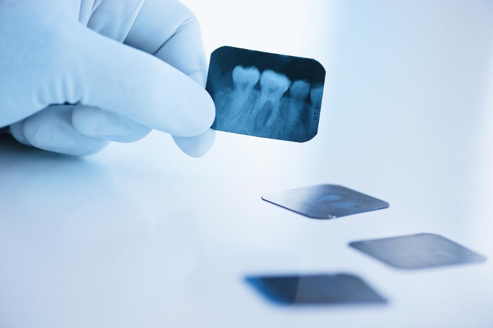 Radiografia odontológica